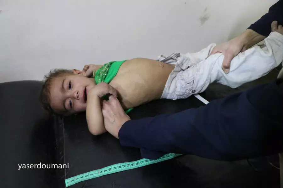 الامم المتحدة تطالب بإدخال المساعدات الى الغوطة الشرقية واجلاء 500 شخص بينهم 167 طفل