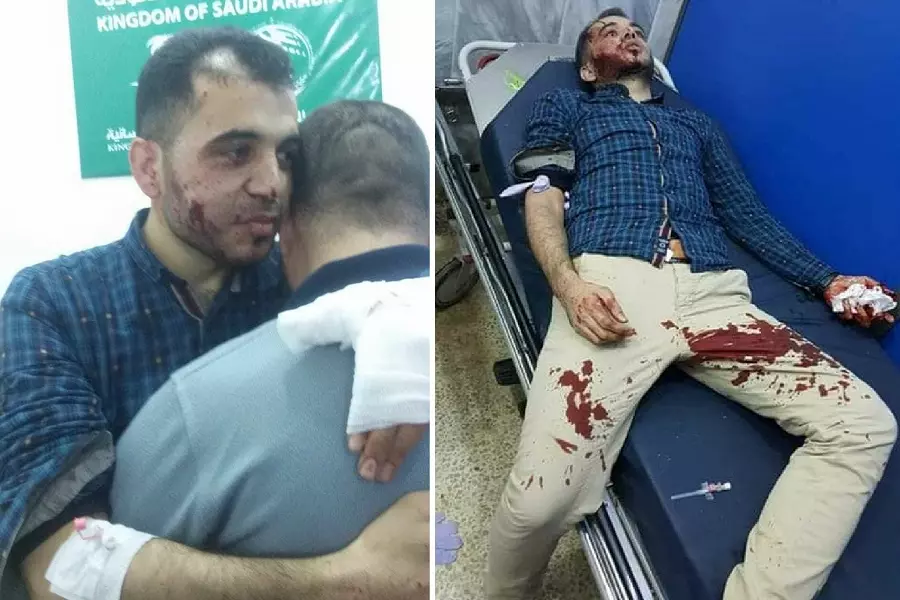 إصابة طبيبان بانفجار عبوة ناسفة استهدفت سيارة مدنية شمالي إدلب