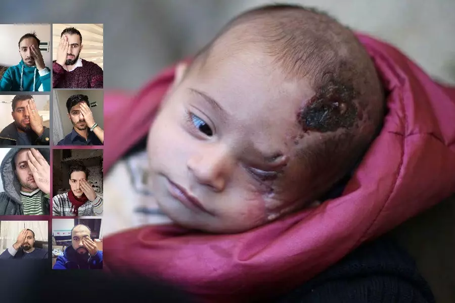 تضامنا مع كريم.. نشطاء يطلقون حملة لتوجيه الضوء إلى معاناة طفل سوري