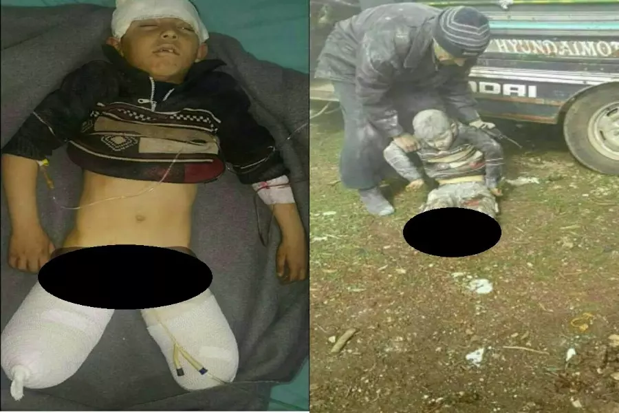 “عبدو” طفل سوري جديد يمزَّق جسده على يد الأسد