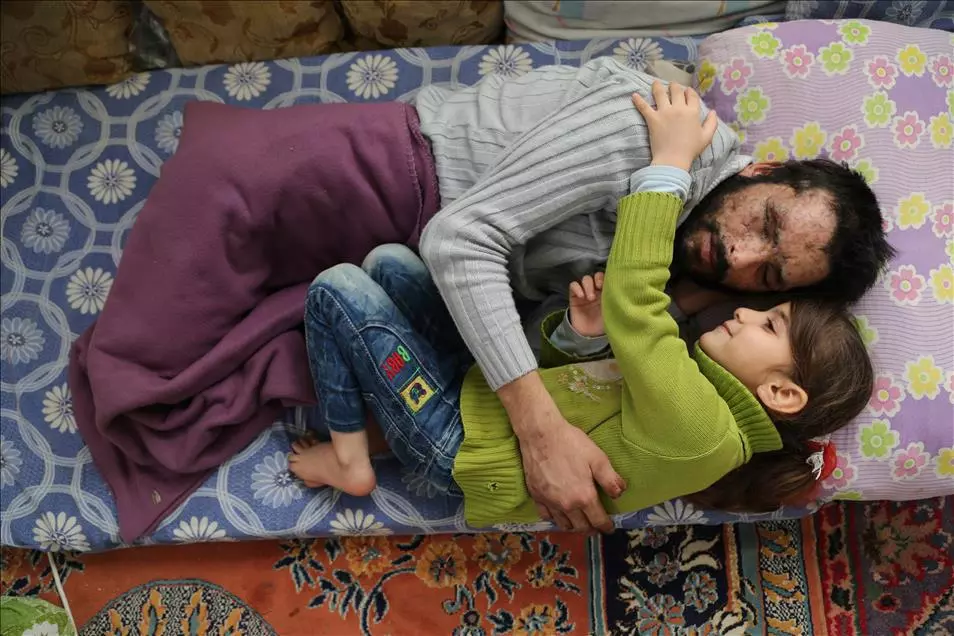 مؤسسة تركية تتعهد بعلاج والد طفلة سورية  طالبة بـ"خذوا عينيّ وأعطوهما لوالدي"