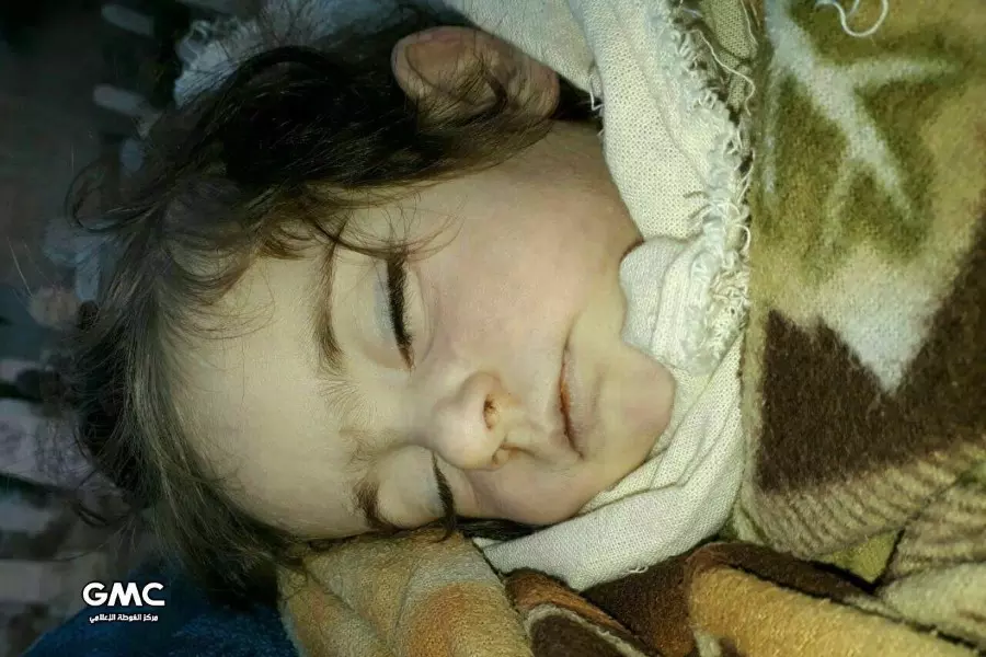 وفاة طفلة جديدة في الغوطة الشرقية بعد إصابتها بالجفاف وسوء التغذية بسبب حصار الأسد