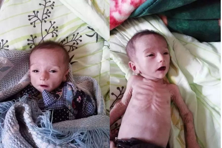 وفاة طفل في بلدة الشعفة شرق ديرالزور بسبب حصار "قسد"