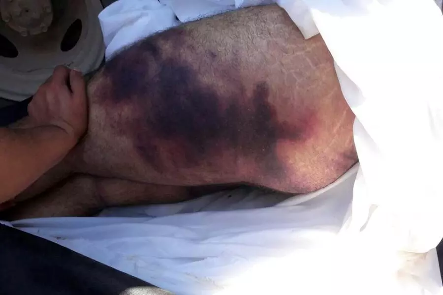 تعقيباً على جريمة تعذيب مدني وقتله في سجونها .. أحرار الشام "نتبرأ من هذا الفعل الإجرامي وتدينه"