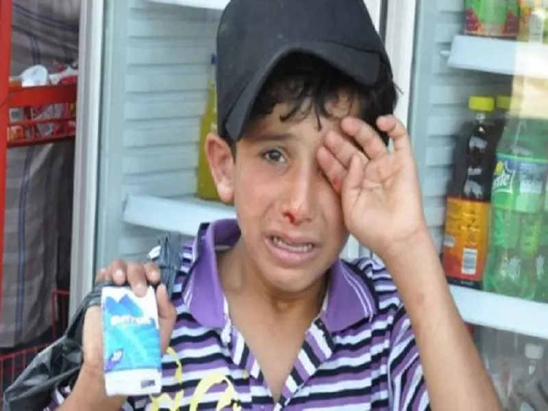 تفاعل قضية الإعتداء على طفل سوري في تركيا .. ضجة واستهجان وبحث عن رادع