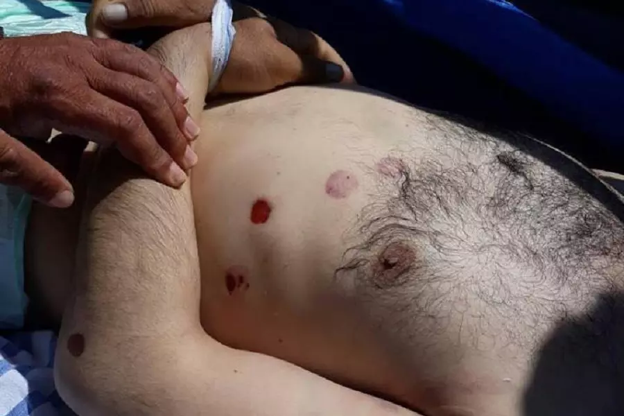 مقتل مدني بسبب التعذيب في سجون "قسد" بعد اعتقاله ليومين من الرقة