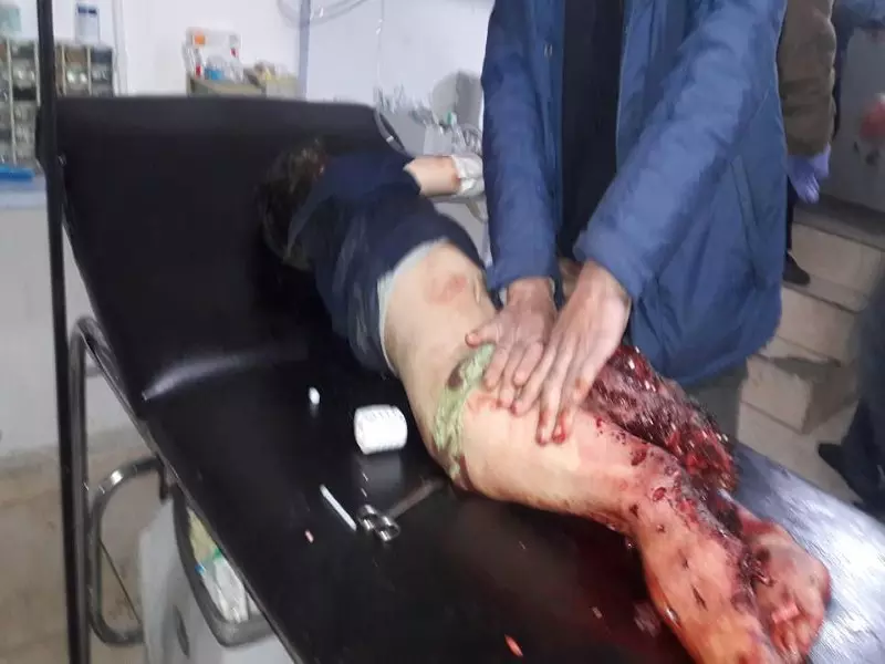 مشفى مضايا يطلق مناشدة لإخراج طفل مصاب بعد وفاة صديقيه