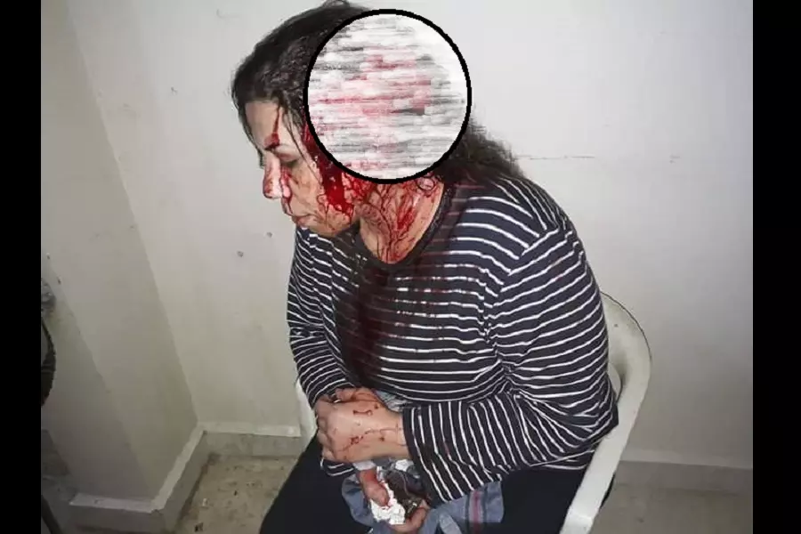 عناصر من قسد يعتدون على الناشطة ريم الناصر في مدينة الرقة