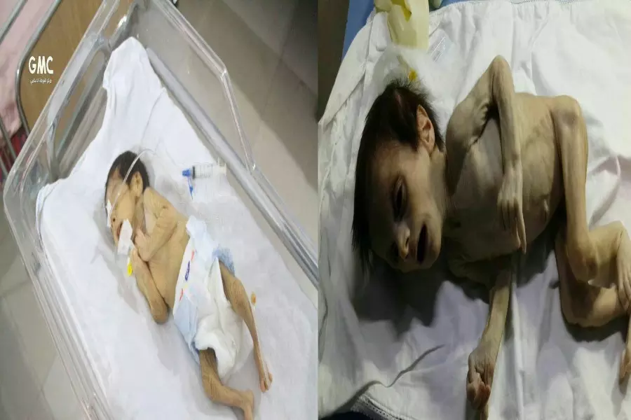 حصار الأسد على الغوطة الشرقية يخطف أحد أطفالها وينذر بتفاقم المأساة