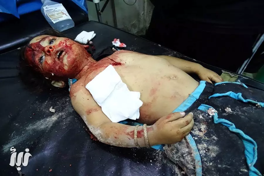 ثلاثة أطفال ضحية القصف الأسدي على سهول درعا