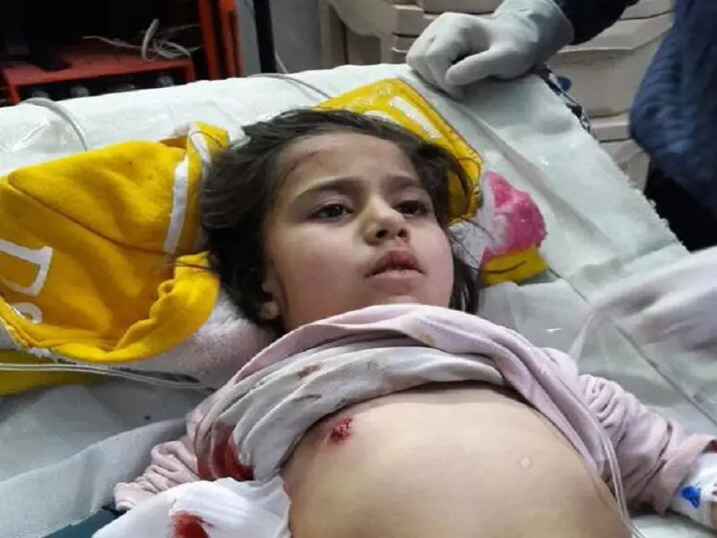 بعد نزيفها لأربع ساعات .. إخراج طفلة من مضايا لتلقي العلاج بعد إصابتها بنيران حزب الله الإرهابي