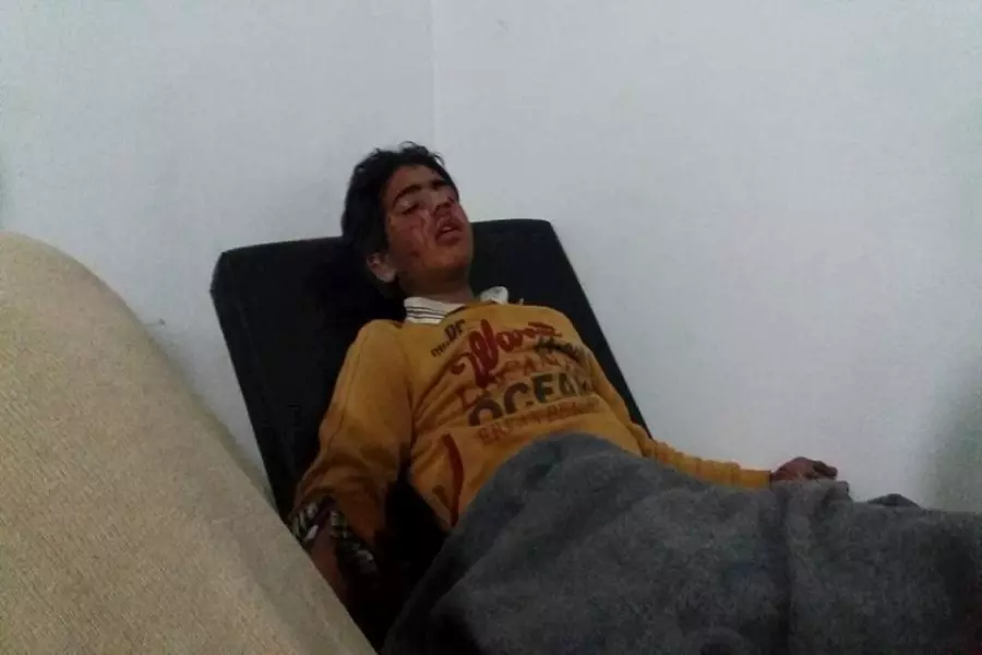 استشهاد طفلة وإصابة عائلة بجروح جراء القصف على الزبداني وبقين ومضايا