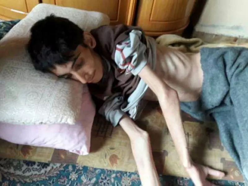 محمد شعبان "طفل مضايا" الذي خذلته الإنسانية.. مثالاً لألاف الجائعين وسط حصار أل الأسد