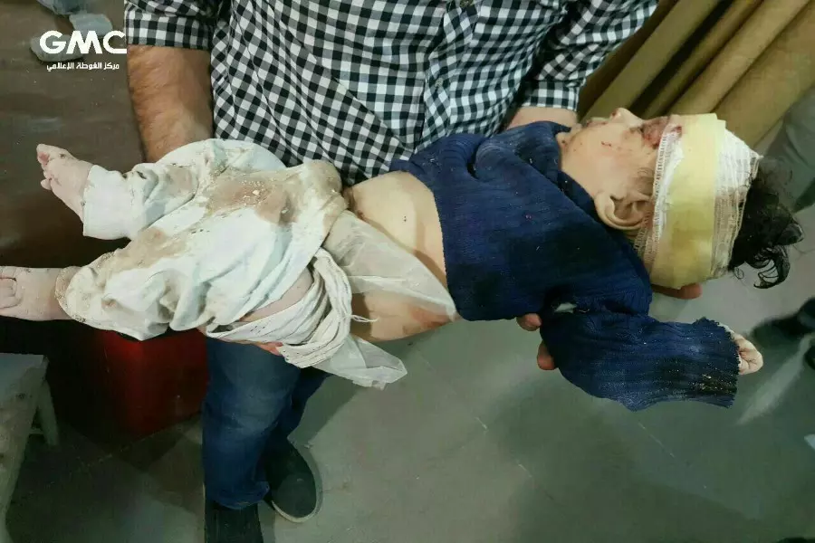 ارتقاء طفل وسقوط عشرات الجرحى جراء قصف عنيف على بلدات الغوطة الشرقية