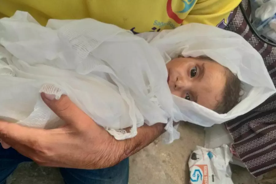 وفاة رضيعة مهجرة من الغوطة بسبب سوء التغذية بمخبم البل شمالي حلب