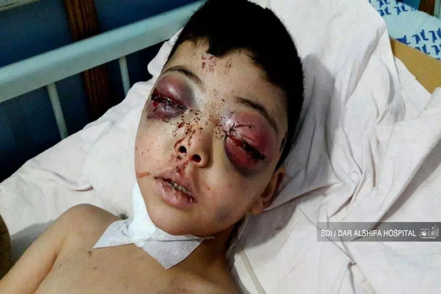 خطف عينيه قصف الأسد.. "أويس" يرافق "كريم" في المأساة في الغوطة المحاصرة