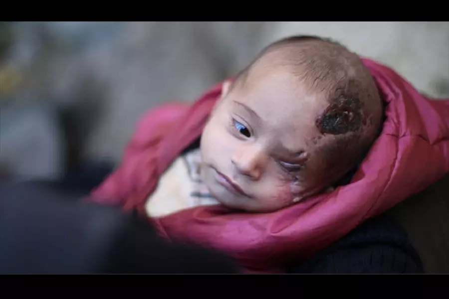 الرضيع "كريم" السوري.. حكاية نزوح وفقد في شهره الأول