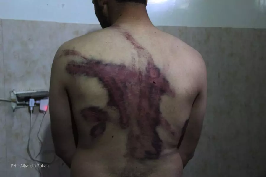 غضب وسخط حول مشاهد تعذيب معتقل بأفرع الشرطة العسكرية بريف حلب
