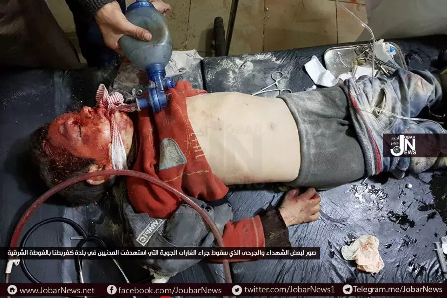 واشنطن بوست: أطباء الغوطة الشرقية ينتظرون معجزة بعد إصابة 2500 شخص بقصف النظام وروسيا