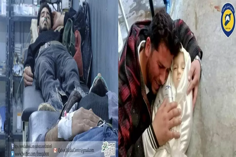 حالات اختناق في القابون .... وشهداء أطفال في الغوطة الشرقية