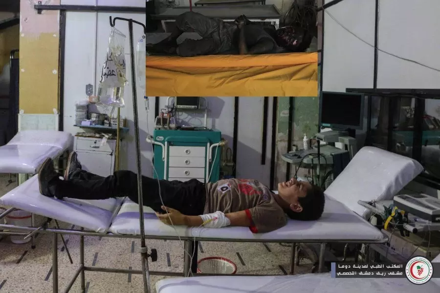 استشهاد طفل حرقا وسقوط جرحى جراء قصف مدفعي على مدينة دوما