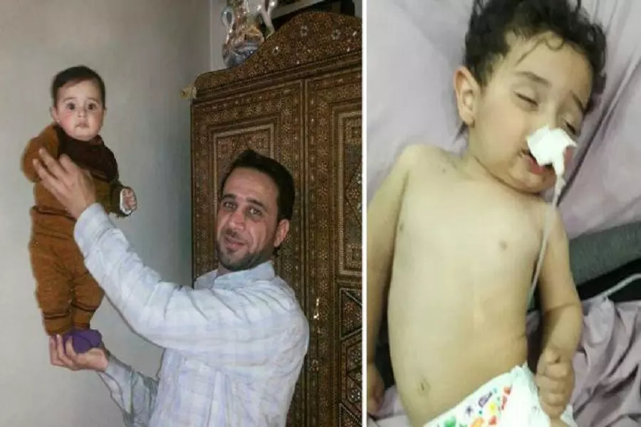 والد الطفل "معتصم بالله" المصاب في الغوطة الشرقية يناشد الرئيس التركي لتعجيل إجلاء طفله لتلقي العلاج في تركيا