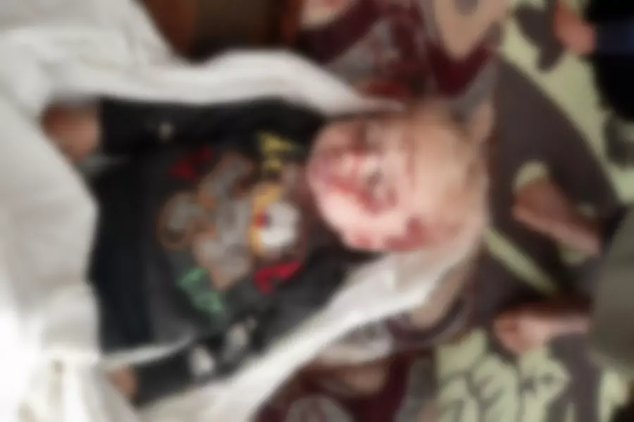 من تبعات الانتشار العشوائي للسلاح ... وفاة طفلة برصاص طائش بمخيم مزن بكللي