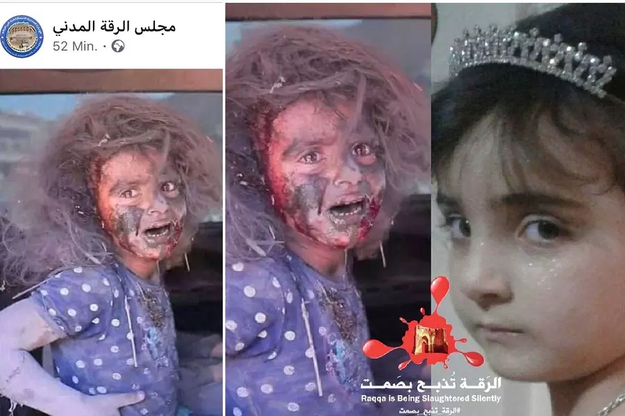 إعلام "قسد" يواصل التضليل وينشر صورة لطفلة قتلت بقصف للتحالف قبل عامين وينسبها للقصف التركي