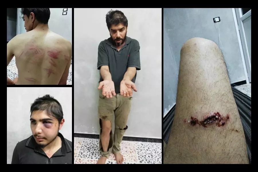 تعذيب وضرب وإهانة للناشط "مازن الشامي" وعائلته على الحدود التركية و"الشامي" يوجه مناشدته للحكومة التركية
