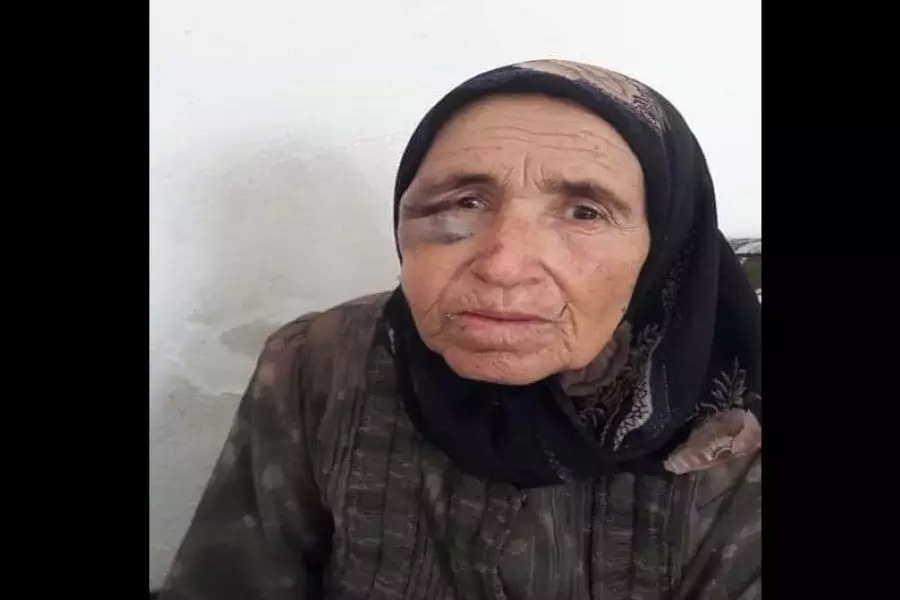 متأثرة بإصابتها .... وفاة مسنة كردية بعد اعتداء مجموعة مسلحة على منزلها بعفرين