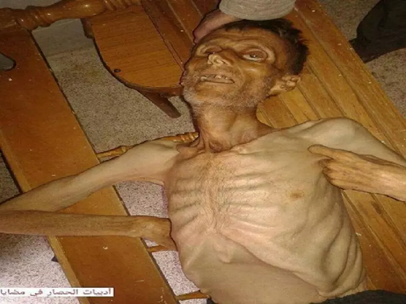 الأمم المتحدة: 400 سوري على حافة الموت بسبب الجوع في مضايا يحتاجون إلى نقلهم للعلاج فورا