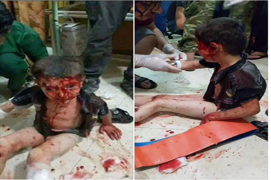 مع بدء عملية "غصن الزيتون" إعلام قسد ينشر صور مفبركة لجرحى مدنيين وينسبها للقصف التركي