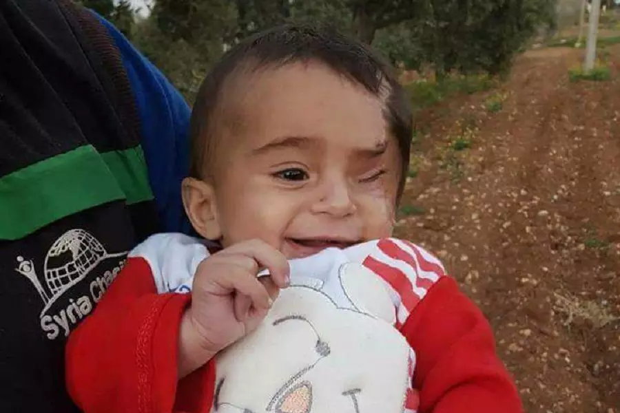 الطفل "كريم" مُهجّراً من الغوطة إلى إدلب والحكومة التركية تتحضر لاستقباله في مشافيها
