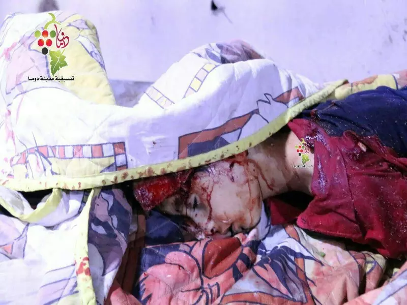 شهيدان وعشرات الجرحى بقصف صاروخي استهدف مدينة دوما