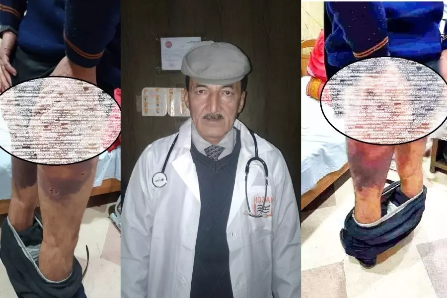 عناصر منتمية لـ "فيلق الشام" تخطف طبيباً من عفرين وتعذبه ومقطع مصور يرشد "الشرطة العسكرية" لهوية خاطفيه