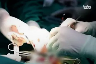 بتقنية جديدة.. عمليات جراحية مستشفى جراحة القلب الجامعي بدمشق