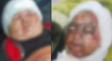 إصابة امرأة وطفلين بحروق خطِرة خلال مداهمة لـ"قسد" بريف دير الزور